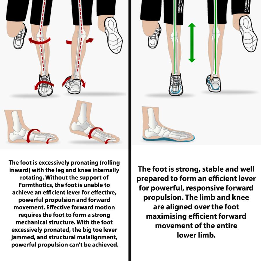 Diagram Of Formthotics Run Dual Orthotics - Dark Green/Blue
